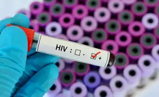 47 Students Die Due To HIV In Tripura, 828 Test Positive; Symptoms And Preventive Measures Of The Infection