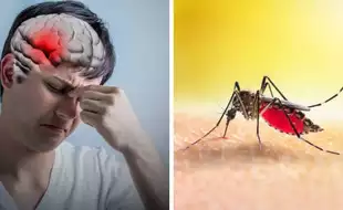 Can Dengue Cause A Stroke? Doctors Warn of Serious Neurological Complications As Cases Surge Across India