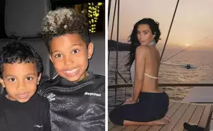 What Is Vitiligo - The Skin Disease Affecting Kim Kardashian’s son?