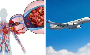 Do Frequent International Flyers Run The Risk Of Blood Clots? All About The Dangers Of Pulmonary Embolism