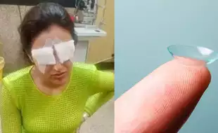 Jasmine Bhasin's Cornea Gets Damages After Wearing Contact Lens; Here Is How Wearing Lenses Can Affect You