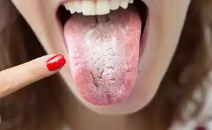 Doctor Shares What Your Tongue’s Appearance Reveals About Health Issues