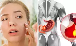 Early Signs Of Stomach Cancer Visible On Your Face You Must Not Ignore