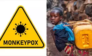 Exponential Spike In Monkeypox Outbreak Affecting Children In DR Congo; Know How