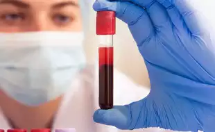 New Blood Test To Detect Colon Cancer Approved By FDA