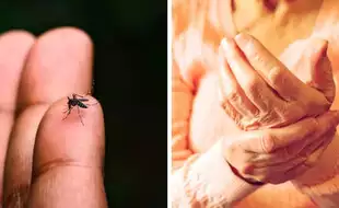 Is Chikungunya More Dangerous Than You Think? All About Debilitating Arthritis Caused By The Mosquito-Borne Virus