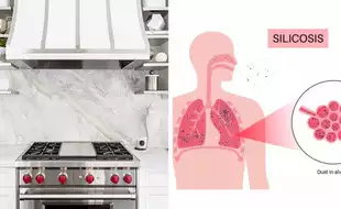 Global Call For A Ban On Trendy Kitchen Worktops Causing Incurable, Rare Lung Disease In Men; Know How