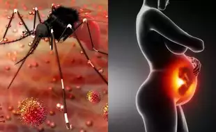 Zika Virus Pune: New Cases Reported In The City, Most In To-Be-Mothers; Know How The Virus Affects The Foetus