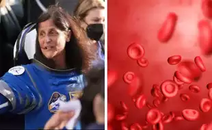 What Is Space Anemia, A Condition That Could Affect Astronaut Sunita Williams?