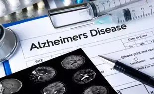 Low Blood Flow To The Brain Causes Alzheimer's Disease; Know Simple Ways to Increase It