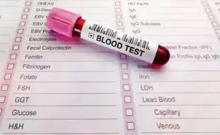 Blood Tests Could Help Predict Alzheimer's, Diabetes, and Other Age-Related Diseases: Study