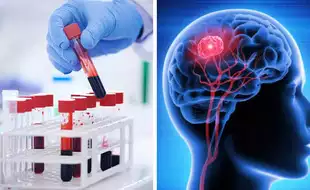 New Breakthrough Blood Test Detects Brain Cancer in Just 60 Minutes