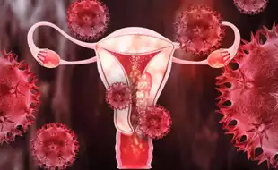 A Third of Women Cannot Identify THIS Common Symptom of Endometrial Cancer