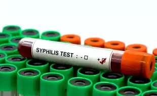 Syphilis Cases At Highest Since 1950s In US - Signs To Watch Out For