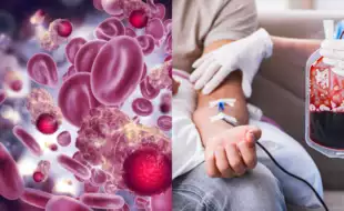 Experts Debunk 8 Very Common Blood Cancer Myths; You Will Be Surprised