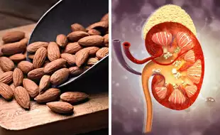 Do Almonds Cause Kidney Stones? Here’s What The Experts Say