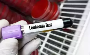 Is Leukemia Hereditary? Know How Understanding Your Genes Can Help In Treatment