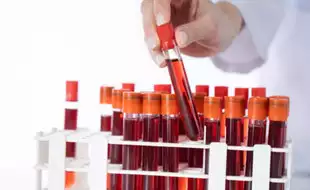 Scientists Find A New Blood Group After 50-year Mystery; How Will It Benefit Those Seeking Transfusion?