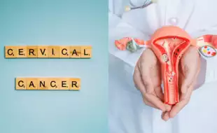 Experts Answer If Cervical Cancer Can Be Prevented at Preteen Age