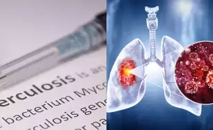 World Lung Day: Vaccination Can Prevent Severe Pulmonary Diseases In India, Say Doctors; Know How They Work