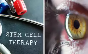 Breakthrough Stem Cell Therapy May Repair Vision-Robbing Holes In Retina