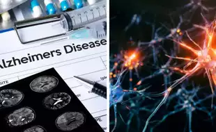 Breakthrough Alzheimer’s Drug Prevents Toxic Protein Build-up In Brain