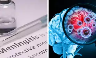 Are We Missing The Signs Of Meningitis Before It's Late? Expert Explains Why You Should Not Ignore This Fatal Disease