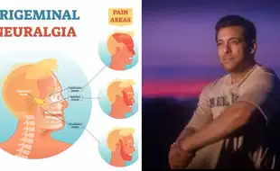 What Is Trigeminal Neuralgia, The Suicide Disease Which Salman Khan Was Once Diagnosed With; Expert-backed Tips To Treat It