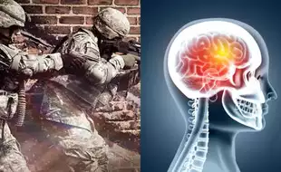 US Military Grapples With Growing Brain Injury Cases; Officials Finding Ways To Protect Troops From Blasts