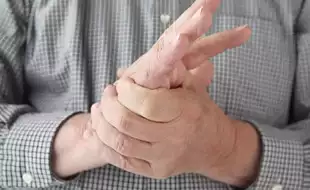 Is Your Knuckle-Cracking Habit Putting You At Risk For Arthritis? Expert Says THIS