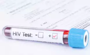 Study Reports Drop In HIV Infections By 22%, HIV-related Deaths By 40%