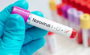 Norovirus Outbreak Shocks The US – Don’t Ignore These Warning Signs!